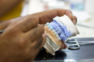 a dentist painting a full mouth all on x dental prosthetic implant model.