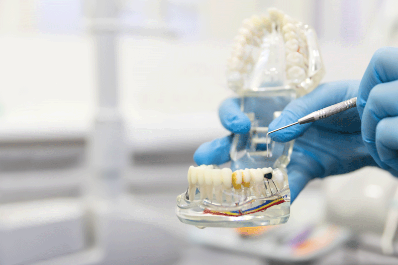 Dentist showing a model of a lower jaw with implants in it with a blurred background